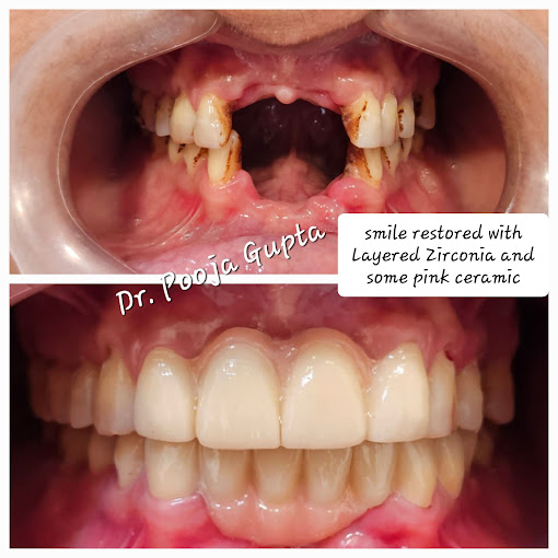 Patient Transformation